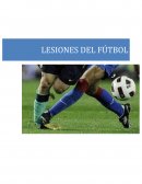 El riesgo de lesión en el deporte es alto. La ejecución deficiente de determinados movimientos,