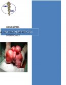 Q es LEIOMIOMA UTERINO Y DIAGNÓSTICOS DIFERENCIALES