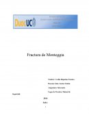 La nueva Fractura de monteggia