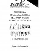 Terceros molares retenidos