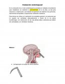 Intubacion endotraqueal