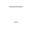 Enfermedad Periodontal. Actualmente el 50 por ciento de las personas padece enfermedad periodontal