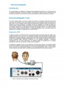 Electroencefalografía