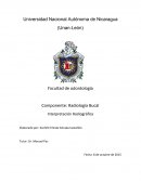 Interpretación radiográfica - Radiología Bucal