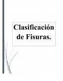 Clasificación de fisuras labiales