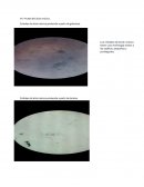 Cristales de ácido múcico producido a partir de galactosa