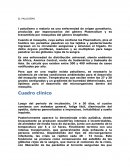 EL PALUDISMO HISTORIA DEL PALUDISMO