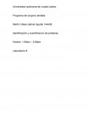 Identificación y cuantificación de proteinas
