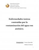 Enfermedades toxicas contraídas por la contaminación del agua con arsénico.