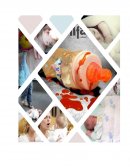Análisis de un caso de un lactante mayor con antecedente de maltrato infantil de tipo físico con desenlace fatal