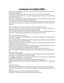 Lesiones en halterofilia