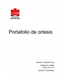 Fracturas de miembro superior.