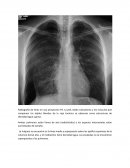 Caso clinico .Radiografía de tórax en una proyección PA.
