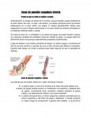 Zonas de punción sanguínea arterial.