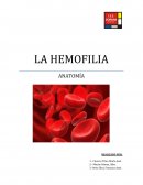 La hemofilia es una enfermedad tan grave, que el paciente muere desangrado
