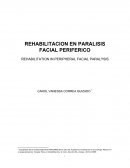 La parálisis facial periférica