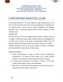 El carcinoma basocelular