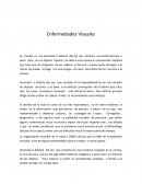 Enfermedades Visuales