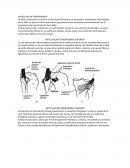 Articulacion tibio peronea