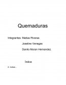 Quemaduras. Informe