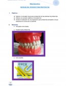 PRACTICA Nº 01 MONTAJE DEL TIPODONT PARA PROTESIS FIJA