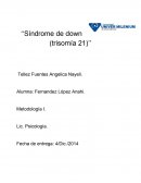 Sintomas y formas de el Sindrome de down