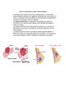 Cáncer crecimiento celular descontrolado