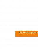 Neumonia por neumococo. Streptococcus pneumoniae