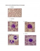 Como se ven los elementos formes al microscopio.