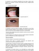 FISIOLOGIA DE CONJUNTIVA