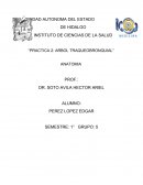 Practica 2: Arbol traqueobronquial