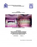 Procedimientos para la modificacion de dientes