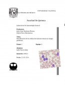 Identificación de las células del sistema inmune en sangre periférica