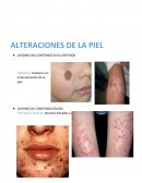 Alteraciones de la piel