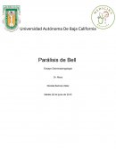 Parálisis de Bell - Revisión del tema