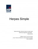 Herpes Simple.