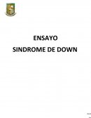 CHILE NO ES APTO PARA LAS PERSONAS CON SINDROME DE DOWN.