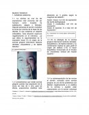 MARCO TEORICO 1. SONRISA GINGIVAL