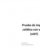 Reflejo vestíbulo ocular (RVO)