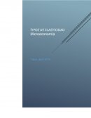 Tipos de elasticidad.