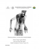 Vibraciones mecánicas y sus efectos sobre la salud del trabajador.