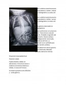 Proyección toracoabdominal.