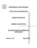 Anemia en niños.