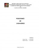 Posición decúbito Dorsal.