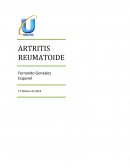 ARTRITIS REUMATOIDE enfermedad sistémica, inflamatoria, crónica