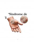 ‘Síndrome de Túnel Carpiano’[