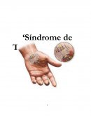 Síndrome de Túnel Carpiano