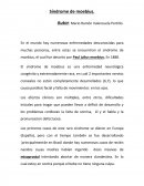 El sindrome de moebius