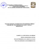 “PLAN DE CUIDADOS A PACIENTE ETR CON DIAGNÓSTICO MÉDICO CORDOMA DEL TECIO INFERIOR DEL CLIVUS + FISTULA + HIDROCEFALIA”