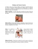 Reflejos del Recién Nacido.